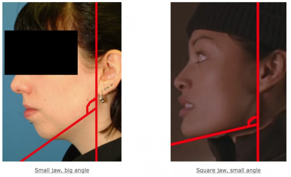 Jaw angle comparison between square and non square woman
