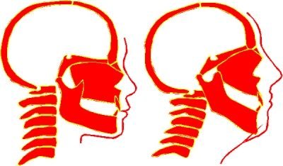 Structural difference between square and non square individuals